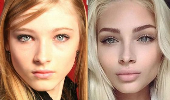 Алена Шишкова биография, фото до и после пластики