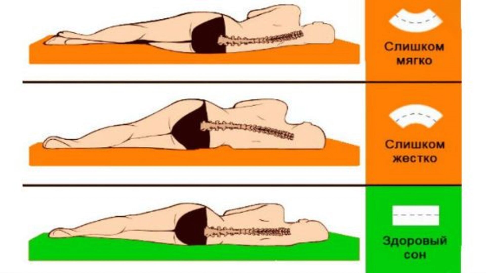 Влияние жесткости матраса на положение позвоночника