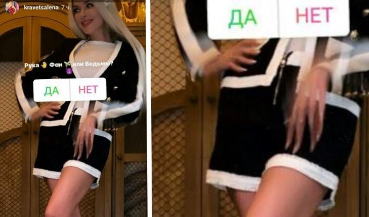 Страшная «ведьминская» рука Алены Кравец