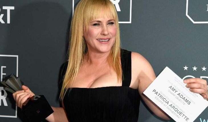 Патрисия Аркетт не стесняется своих зубов