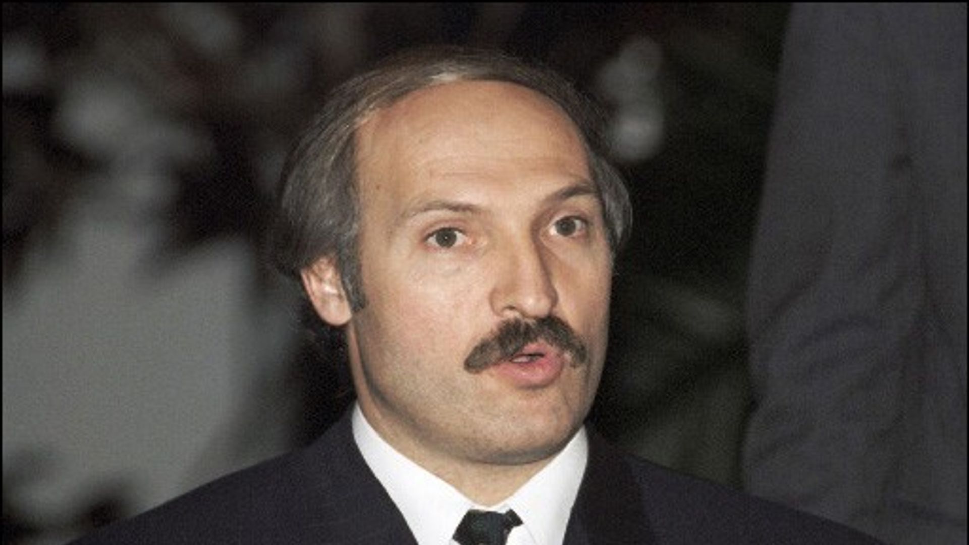 8 известных людей, родившихся с заячьей губой