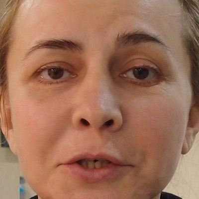 Ирина Александровна после операции Ирина Александровна после операции