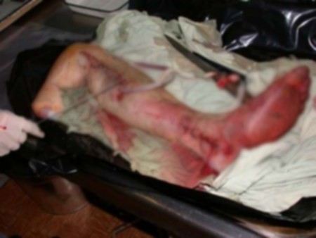 В Волгограде автоворы украли из спецавтомобиля контейнер с ампутированной ногой. В Волгограде автоворы украли из спецавтомобиля контейнер с ампутированной ногой.