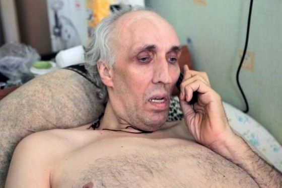 Перед смертью рост баскетболиста Александра Сизоненко составлял 245 см Перед смертью рост баскетболиста Александра Сизоненко составлял 245 см