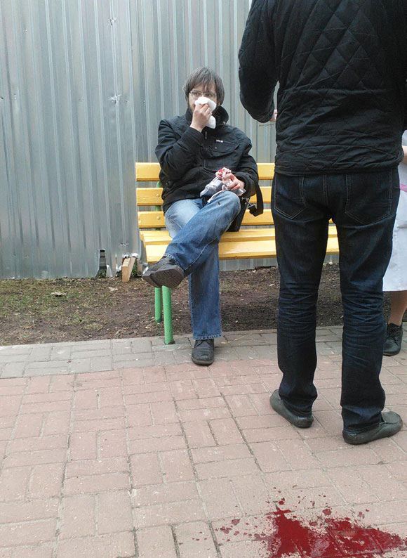 В Балашихе на местных выборах избили наблюдателей В Балашихе на местных выборах избили наблюдателей