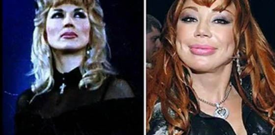 Маша утверждает, что не делала пластику Маша утверждает, что не делала пластику