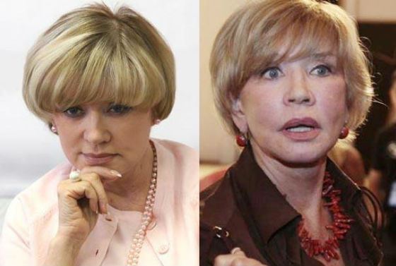 Вера Алентова столкнулась с осложнениями после подтяжки Вера Алентова столкнулась с осложнениями после подтяжки