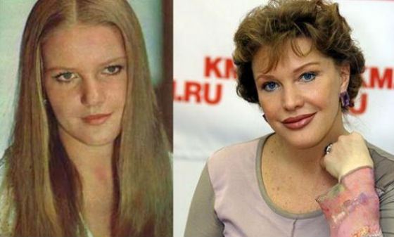 Елена Проклова несколько раз корректировала внешность Елена Проклова несколько раз корректировала внешность